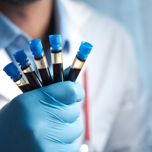 esr test (erythrocyte sedimentation rate test)
